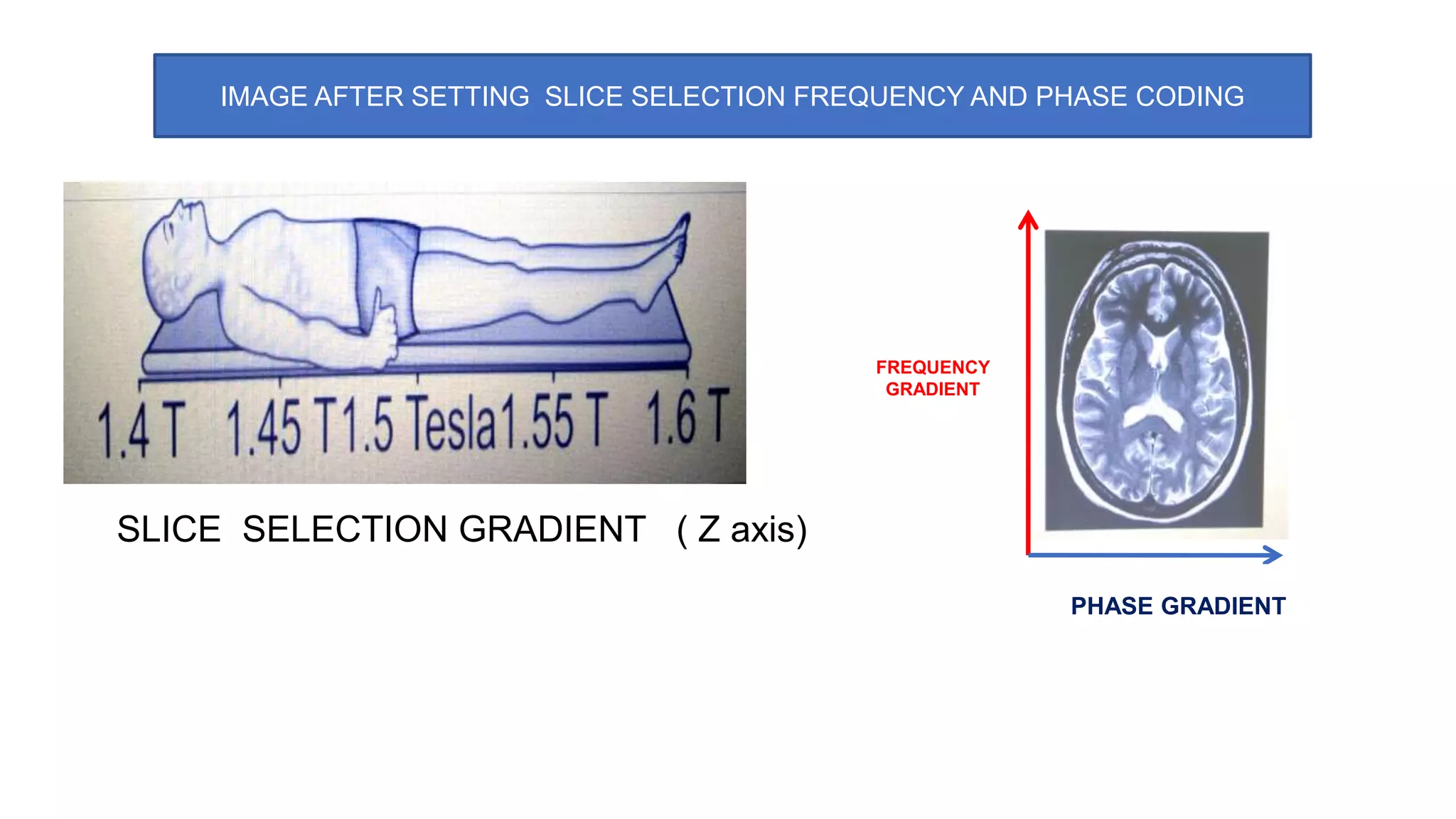 IMAGE AFTER SETTING SLICE SELECTION FREQUENCY AND PHASE CODING
FREQUENCY
GRADIENT
PHASE GRADIENT
SLICE SELECTION GRADIENT ( Z axis)
 