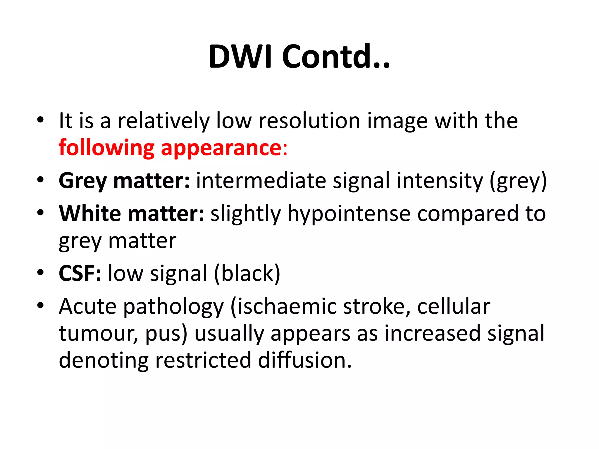 MRI of Brain: Basics | PPTX