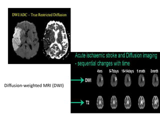 MRI of Brain: Basics | PPTX