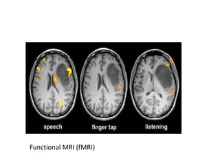 MRI of Brain: Basics | PPTX