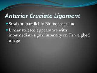 Anterior Cruciate Ligament
 Straight, parallel to Blumensaat line
 Linear striated appearance with
intermediate signal intensity on T2 weighed
image
 