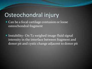 Osteochondral injury
 Can be a focal cartilage contusion or loose
osteochondral fragment
 Instability- On T2 weighed image fluid signal
intensity in the interface between fragment and
donor pit and cystic change adjacent to donor pit
 