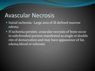 Avascular Necrosis
 Initial ischemia- Large area of ill defined marrow
edema
 If ischemia persists- avascular necrosis of bone occur
in subchondral portion manifested as single or double
rim of demarcation and may have appearance of fat,
edema,blood or sclerosis
 
