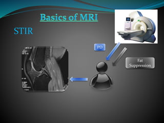 PD
Fat
Suppression
STIR
 