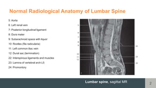 MRI of Lumbar Spine _DR Mohammad Rakib.pptx