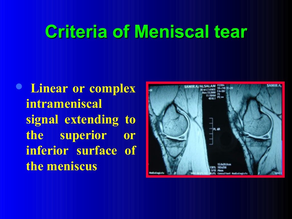 mri-of-the-knee-ppt