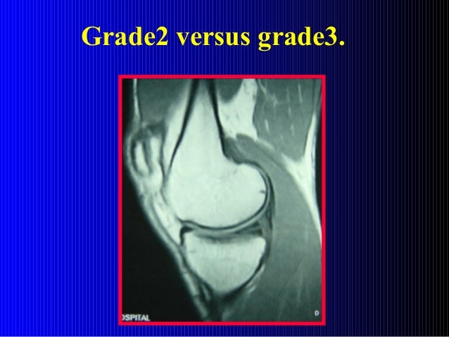 mri-of-the-knee-ppt
