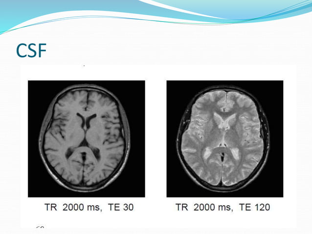 MRI Parameters for Imaging | PPTX
