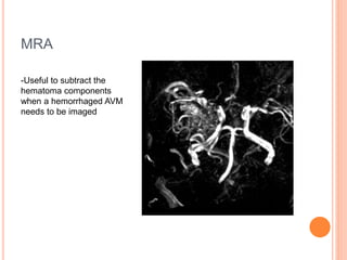MRA
-Useful to subtract the
hematoma components
when a hemorrhaged AVM
needs to be imaged
 