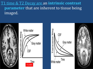 T1 time & T2 Decay are an intrinsic contrast
parameter that are inherent to tissue being
imaged.

T1WI

 