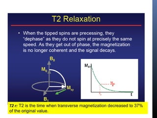 T2 r: T2 is the time when transverse magnetization decreased to 37%
of the original value.
 