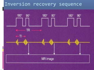 Inversion recovery sequence
 