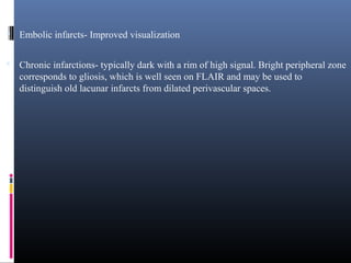  Embolic infarcts- Improved visualization
 Chronic infarctions- typically dark with a rim of high signal. Bright peripheral zone
corresponds to gliosis, which is well seen on FLAIR and may be used to
distinguish old lacunar infarcts from dilated perivascular spaces.
 