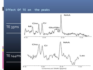 Effect Of TE on the peaks
__________
TE 35ms
___________
___________
TE 144ms
__________
 