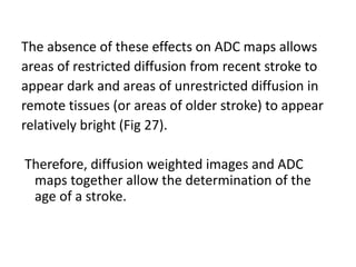 The absence of these effects on ADC maps allows
areas of restricted diffusion from recent stroke to
appear dark and areas of unrestricted diffusion in
remote tissues (or areas of older stroke) to appear
relatively bright (Fig 27).
Therefore, diffusion weighted images and ADC
maps together allow the determination of the
age of a stroke.
 