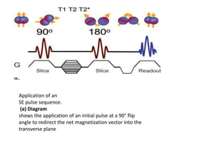 Application of an
SE pulse sequence.
(a) Diagram
shows the application of an initial pulse at a 90° flip
angle to redirect the net magnetization vector into the
transverse plane
 