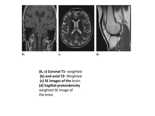 (b, c) Coronal T1- weighted
(b) and axial T2- Weighted
(c) SE images of the brain.
(d) Sagittal protondensity
weighted SE image of
the knee.
 