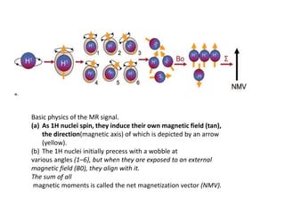 Basic physics of the MR signal.
(a) As 1H nuclei spin, they induce their own magnetic field (tan),
the direction(magnetic axis) of which is depicted by an arrow
(yellow).
(b) The 1H nuclei initially precess with a wobble at
various angles (1–6), but when they are exposed to an external
magnetic field (B0), they align with it.
The sum of all
magnetic moments is called the net magnetization vector (NMV).
 