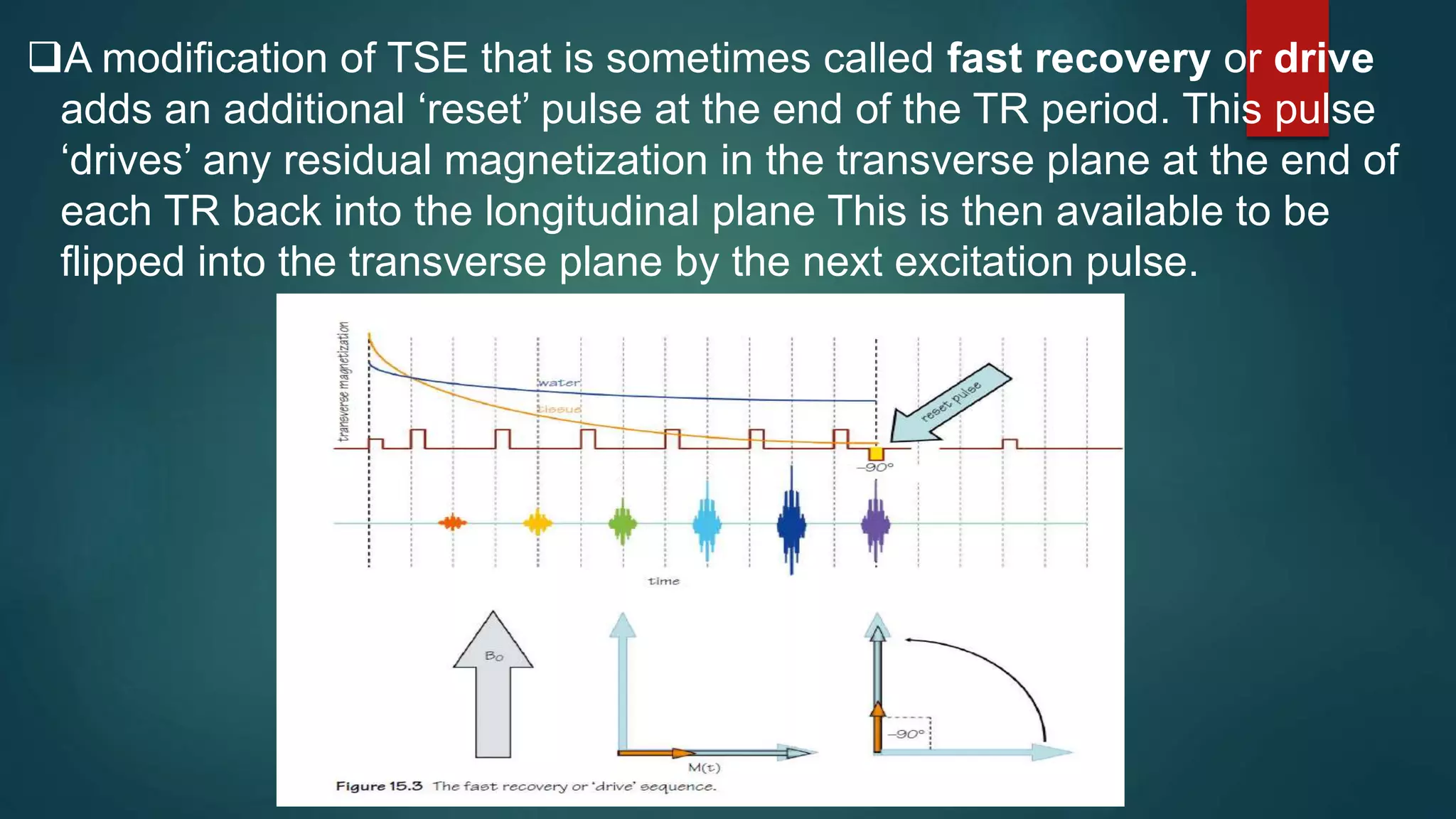 A modification of TSE that is sometimes called fast recovery or drive
adds an additional ‘reset’ pulse at the end of the TR period. This pulse
‘drives’ any residual magnetization in the transverse plane at the end of
each TR back into the longitudinal plane This is then available to be
flipped into the transverse plane by the next excitation pulse.
 