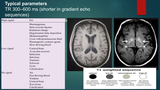 Typical parameters
TR 300–600 ms (shorter in gradient echo
sequences)
TE 10–30 ms (shorter in gradient echo
sequences)
 