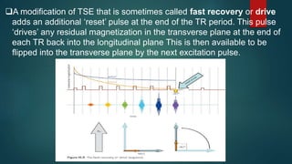 A modification of TSE that is sometimes called fast recovery or drive
adds an additional ‘reset’ pulse at the end of the TR period. This pulse
‘drives’ any residual magnetization in the transverse plane at the end of
each TR back into the longitudinal plane This is then available to be
flipped into the transverse plane by the next excitation pulse.
 