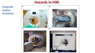 Mri Projectile Risk Overview of MRI Physics, Equipment, and Safety Hazards | PPTX