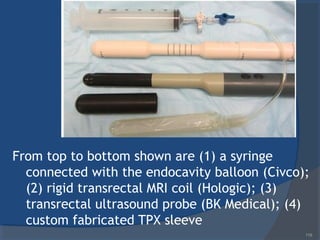 From top to bottom shown are (1) a syringe
connected with the endocavity balloon (Civco);
(2) rigid transrectal MRI coil (Hologic); (3)
transrectal ultrasound probe (BK Medical); (4)
custom fabricated TPX sleeve
119
 