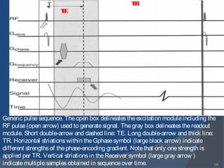126
Generic pulsesequence. Theopen box delineatestheexcitation moduleincluding the
RF pulse(open arrow) used to generatesignal. Thegray box delineatesthereadout
module. Short double-arrow and dashed line: TE. Long double-arrow and thick line:
TR. Horizontal striationswithin theGphasesymbol (largeblack arrow) indicate
different strengthsof thephase-encoding gradient. Notethat only onestrength is
applied per TR. Vertical striationsin theReceiver symbol (largegray arrow )
indicatemultiplesamplesobtained in sequenceover time.
TE
TR
 