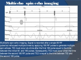 136
Multiecho spin echo imaging
Multiecho spin echo imaging. Signal isrecorded after asingle90 RF
pulsebut refocused multipletimesby applying 180 RF pulsesto generatemultiple
spin echoes. TEl must occur at atimeafter thefirst 180 pulseequal to thetime
between theinitial 90 and 180 pulses. Subsequently,TE2 must occur when thetime
between thesecond 180 RF pulseand TE2 isequal to thetimebetween TEl and
thesecond 180 pulse.
 