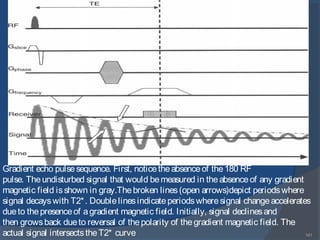 141
Gradient echo pulsesequence. First, noticetheabsenceof the180 RF
pulse. Theundisturbed signal that would bemeasured in theabsenceof any gradient
magnetic field isshown in gray.Thebroken lines(open arrows)depict periodswhere
signal decayswith T2*. Doublelinesindicateperiodswheresignal changeaccelerates
dueto thepresenceof agradient magnetic field. Initially, signal declinesand
then growsback dueto reversal of thepolarity of thegradient magnetic field. The
actual signal intersectstheT2* curve
 