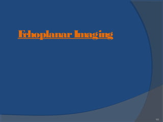 163
EchoplanarImaging
 