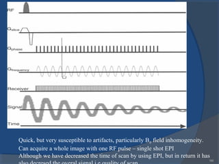 166
Quick, but very susceptible to artifacts, particularly B0 field inhomogeneity.
Can acquire a whole image with one RF pulse – single shot EPI
Although we have decreased the time of scan by using EPI, but in return it has
 