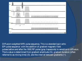 173
Diffusion-weighted MRI pulsesequence. Thisisastandard spin echo
EPI pulsesequence with theaddition of gradient magnetic field
pulsesbeforeand after the1800 RF pulse(gray trapezoids) to sensitizeto diffusion.
Theb-valueisdetermined from gradient amplitude(G), gradient duration (often
referred to asmixing time) (0), and theinterval between gradients(~).
 