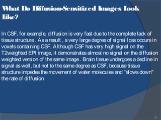175
What Do Diffusion-Sensitized Images Look
Like?
In CSF, for example, diffusion isvery fast dueto thecompletelack of
tissuestructure. Asaresult , avery largedegreeof signal lossoccursin
voxelscontaining CSF. Although CSF hasvery high signal on the
T2weighted EPI image, it demonstratesalmost no signal on thediffusion
weighted version of thesameimage. Brain tissueundergoesadeclinein
signal aswell, but not to thesamedegreeasCSF, becausetissue
structureimpedesthemovement of water moleculesand "slowsdown"
therateof diffusion
 