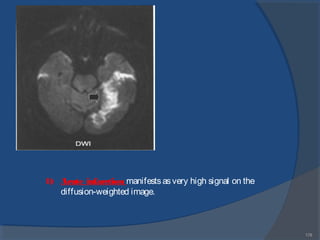 178
1) Acute infarction manifestsasvery high signal on the
diffusion-weighted image.
 
