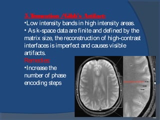 193
5.Truncation /Gibb’s Artifact:
•Low intensity bandsin high intensity areas.
• Ask-spacedataarefiniteand defined by the
matrix size, thereconstruction of high-contrast
interfacesisimperfect and causesvisible
artifacts. 
Remedies:
•Increasethe
number of phase
encoding steps
 
