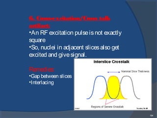 194
6. Cross-excitation/Cross talk
artifact:
•An RF excitation pulseisnot exactly
square
•So, nuclei in adjacent slicesalso get
excited and givesignal.
Remedies:
•Gap between slices
•Interlacing
 