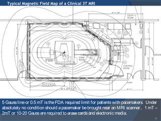 Typical Magnetic Field Map of a Clinical 3T MRI
75
5 Gausslineor 0.5 mT istheFDA required limit for patientswith pacemakers. Under
absolutely no condition should apacemaker bebrought near an MRI scanner.. 1 mT –
2mT or 10-20 Gaussarerequired to erasecardsand electronic media.
 