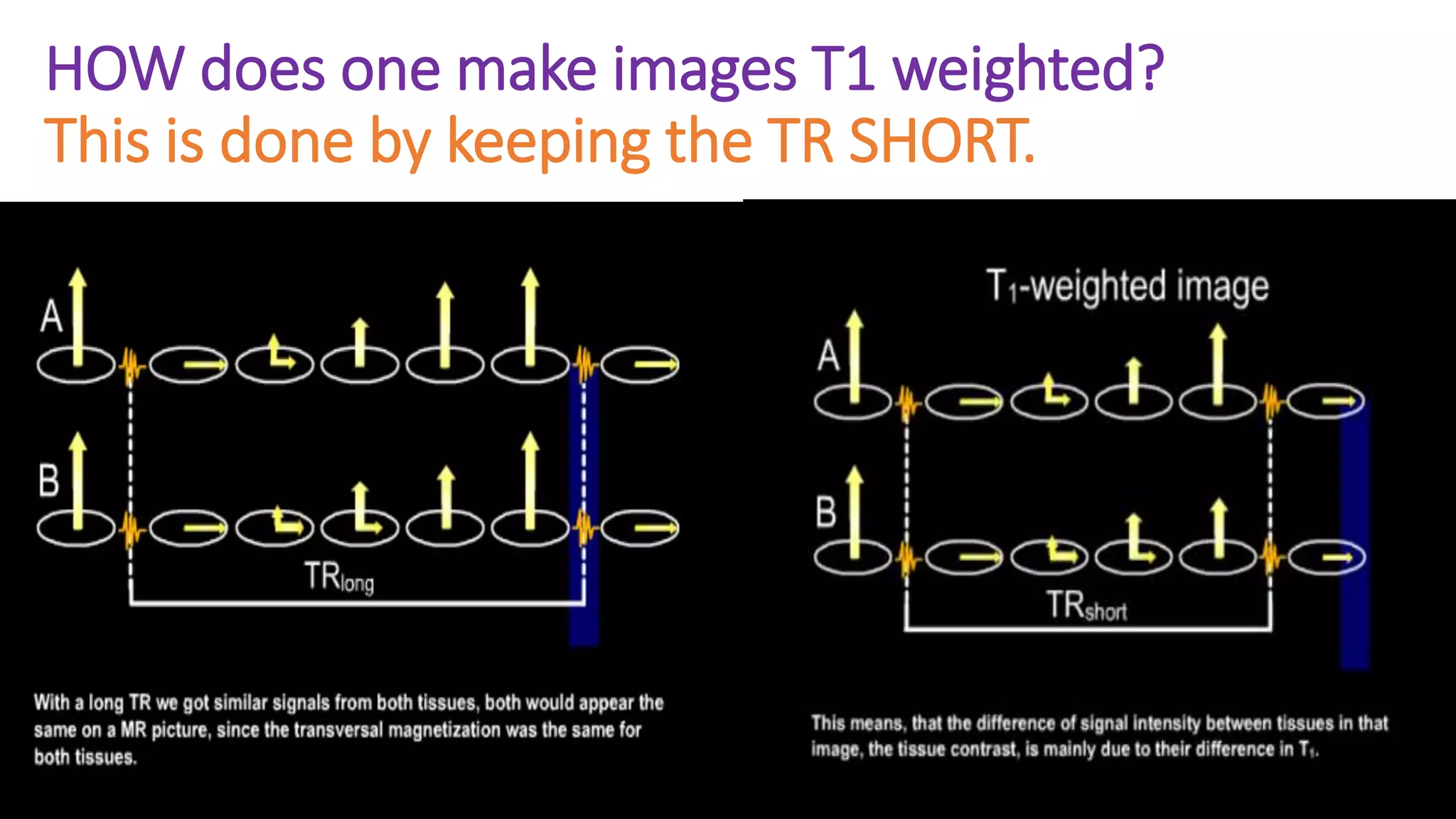 HOW does one make images T1 weighted?
This is done by keeping the TR SHORT.
 