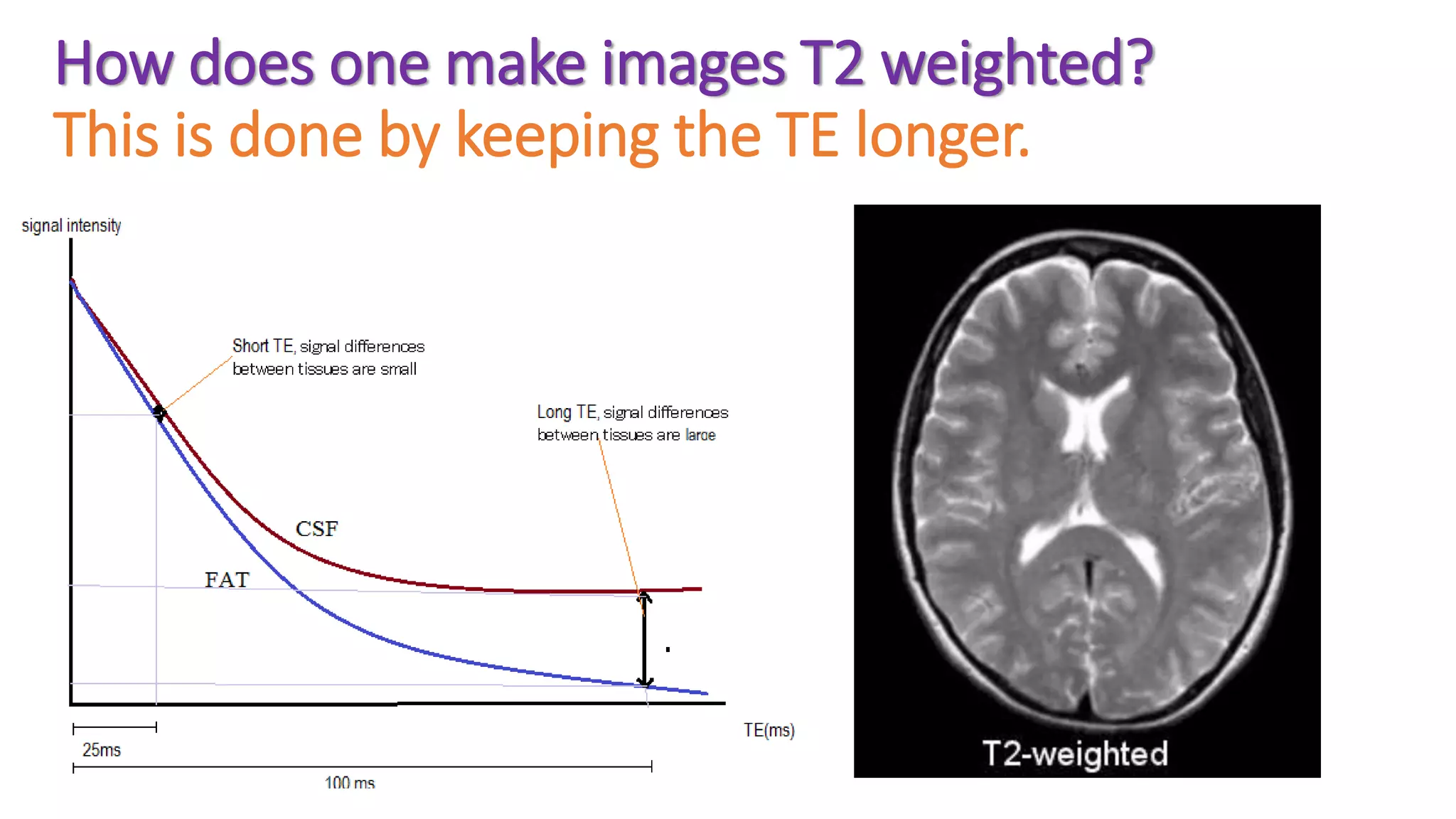 How does one make images T2 weighted?
This is done by keeping the TE longer.
 
