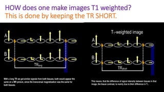 HOW does one make images T1 weighted?
This is done by keeping the TR SHORT.
 