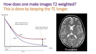 How does one make images T2 weighted?
This is done by keeping the TE longer.
 