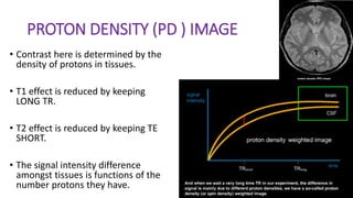 PROTON DENSITY (PD ) IMAGE
• Contrast here is determined by the
density of protons in tissues.
• T1 effect is reduced by keeping
LONG TR.
• T2 effect is reduced by keeping TE
SHORT.
• The signal intensity difference
amongst tissues is functions of the
number protons they have.
 