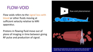 FLOW-VOID
Flow voids refers to the signal loss with
blood or other fluids moving at
sufficient velocity relative to MRI
apparatus.
Protons in flowing fluid move out of
plane of imaging in time between giving
RF pulse and production of signal.
 