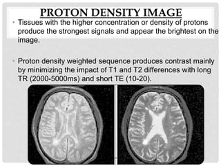 PROTON DENSITY IMAGE
• Tissues with the higher concentration or density of protons
produce the strongest signals and appear the brightest on the
image.
• Proton density weighted sequence produces contrast mainly
by minimizing the impact of T1 and T2 differences with long
TR (2000-5000ms) and short TE (10-20).
 