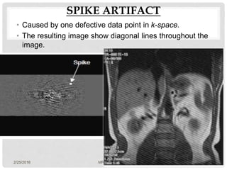 SPIKE ARTIFACT
• Caused by one defective data point in k-space.
• The resulting image show diagonal lines throughout the
image.
2/25/2016 MRI artifacts-sudil 49
 