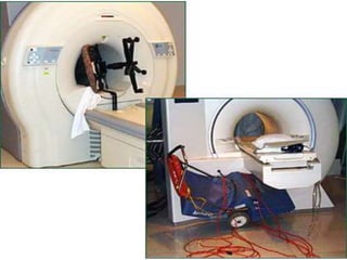 METAL OBJECTS BECOMING
PROJECTILES
 