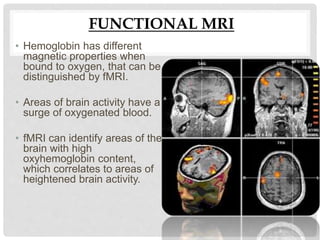 FUNCTIONAL MRI
• Hemoglobin has different
magnetic properties when
bound to oxygen, that can be
distinguished by fMRI.
• Areas of brain activity have a
surge of oxygenated blood.
• fMRI can identify areas of the
brain with high
oxyhemoglobin content,
which correlates to areas of
heightened brain activity.
 