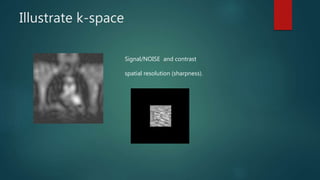 Illustrate k-space
Signal/NOISE and contrast
spatial resolution (sharpness).
 