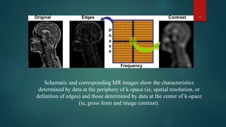54
Schematic and corresponding MR images show the characteristics
determined by data at the periphery of k-space (ie, spatial resolution, or
definition of edges) and those determined by data at the center of k-space
(ie, gross form and image contrast).
 